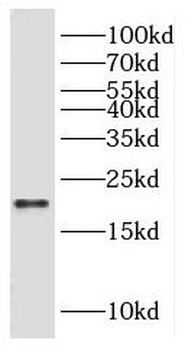 HSPB8 Rabbit Polyclonal Antibody