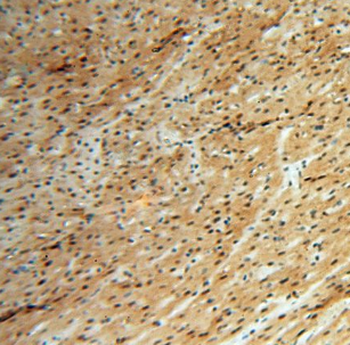 HSPB8 Rabbit Polyclonal Antibody
