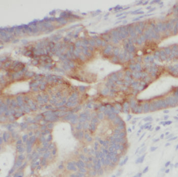 HSPBP1 Antibody