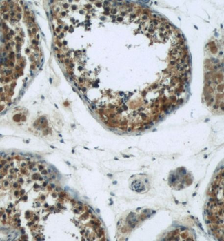 HSPH1 Rabbit Polyclonal Antibody