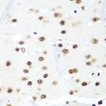 HTATSF1 Antibody