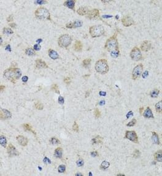 HTR3A Antibody