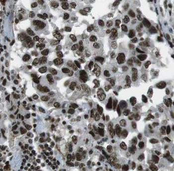 HYAL2 Antibody
