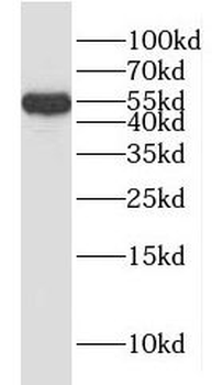 HYAL3 Rabbit Polyclonal Antibody