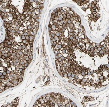 HYAL3 Rabbit Polyclonal Antibody