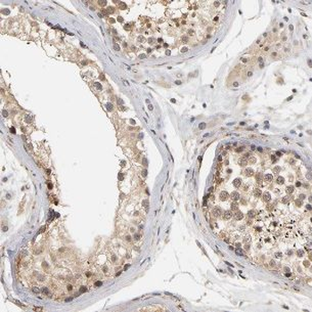 HYDIN Antibody