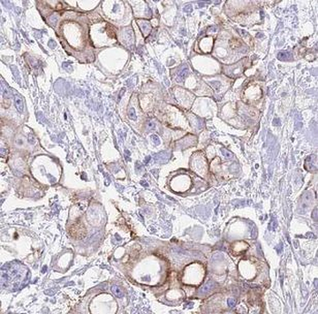 PTPRN Antibody