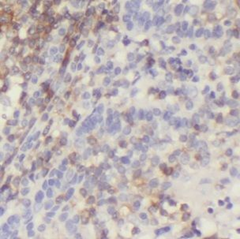 ICAM1 Antibody