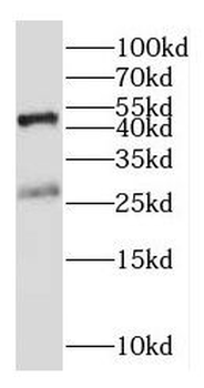ICOS Rabbit Polyclonal Antibody