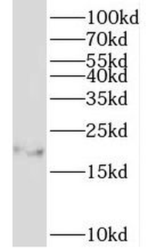 ID1 Rabbit Polyclonal Antibody