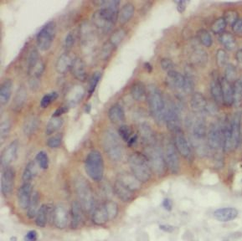 IDH2 Antibody