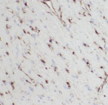 IDH3A Antibody