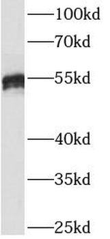 IDS Antibody