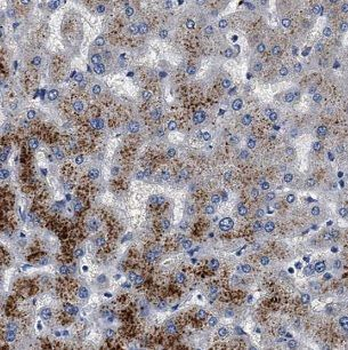 IDS Antibody