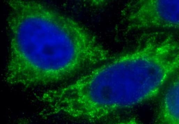 IFIT2 Antibody