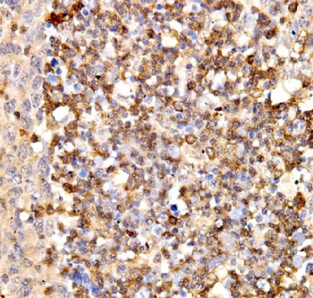 IFIT3 Antibody
