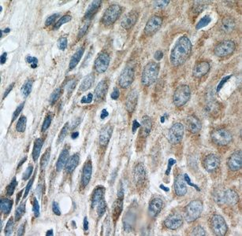 IFIT5 Antibody