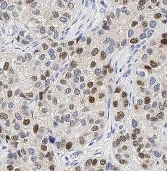 IFITM2 Antibody
