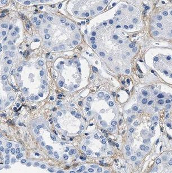IFNAR1 Antibody