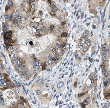 IFNGR1 Antibody