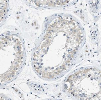 IFT122 Antibody