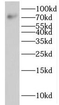 IFT81 Antibody