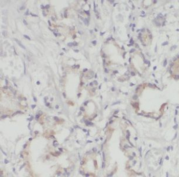 IFT81 Antibody