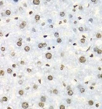 IGF2BP2 Antibody