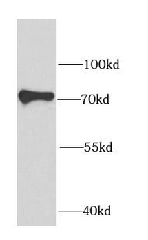 IGF2BP3 Antibody
