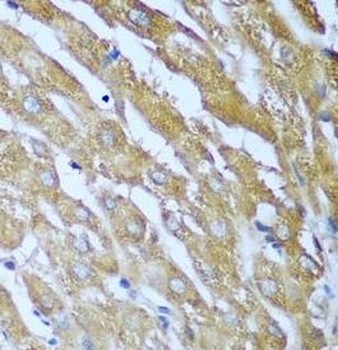 IGF2BP3 Antibody