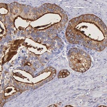 IGFBP2 Antibody