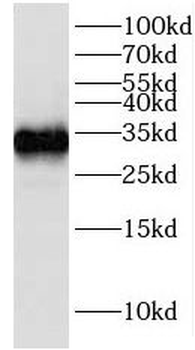 IGFBP2 Rabbit Polyclonal Antibody