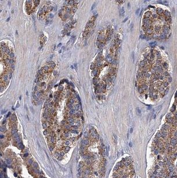 IGFBP2 Rabbit Polyclonal Antibody