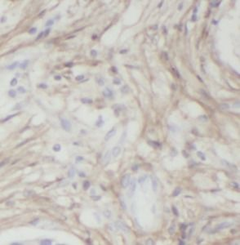 IGFBP3 Antibody