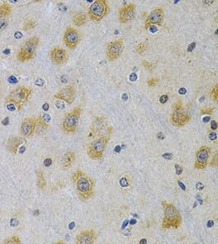 IGFBP4 Antibody