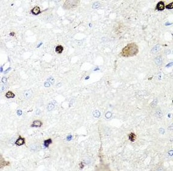 IGFBP5 Antibody