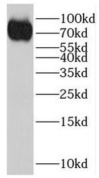 IGHM Rabbit Polyclonal Antibody