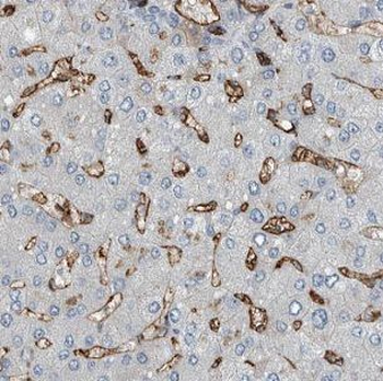 IGHMBP2 Antibody
