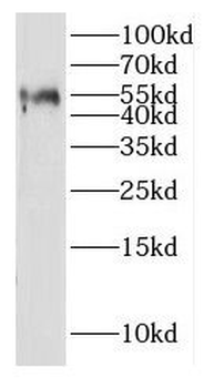 IGSF21 Antibody