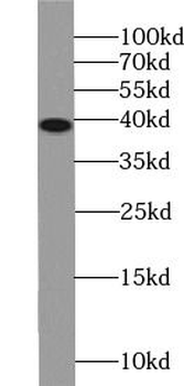NFKBIA Rabbit Polyclonal Antibody