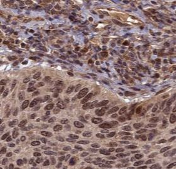 NFKBIA Rabbit Polyclonal Antibody
