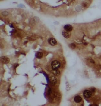 NFKBIA Rabbit Polyclonal Antibody