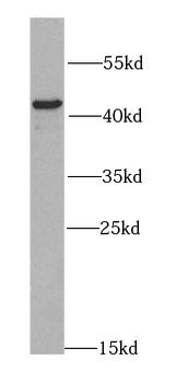 IKBKG Rabbit Polyclonal Antibody