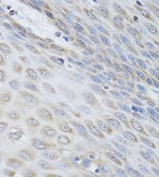 IKBKG Rabbit Polyclonal Antibody