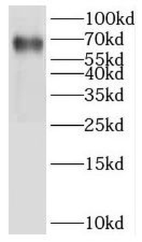 IKZF2 Antibody