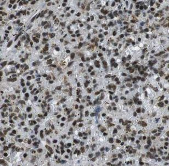 IKZF3 Antibody