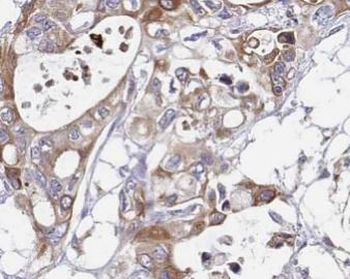 IL10 Antibody