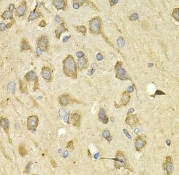IL10RA Antibody