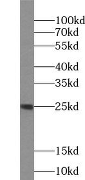 IL11 Rabbit Polyclonal Antibody