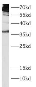 IL12B Rabbit Polyclonal Antibody